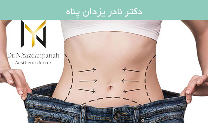 مرکز تخصصی پیکرتراشی در کیش